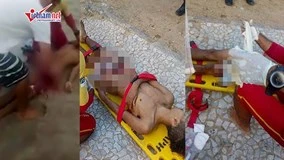 Chàng trai đi bơi ở bãi biển bị cá mập cắn đứt 'của quý'