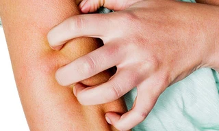 Dấu hiệu cảnh báo lượng đường huyết quá cao trong cơ thể