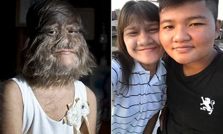 Cạo sạch lông mặt, nữ 'người sói' Thái Lan gây sửng sốt với nhan sắc 