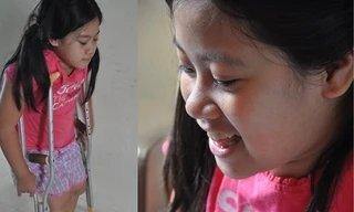 Cô bé lớp 5 có cột sống cong hình chữ... S