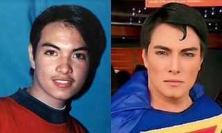 Chàng trai trẻ 'hóa' siêu nhân sau 23 lần phẫu thuật