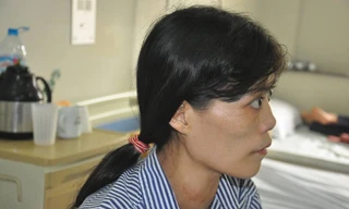 Suýt chết vì điều trị bệnh Basedow bằng thuốc nam