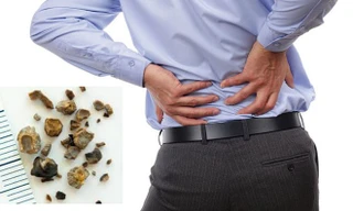 Ảnh minh họa: Internet