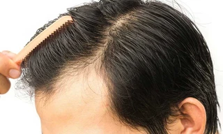 Ảnh minh hoạ: Internet