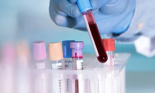 Ảnh minh họa: Internet