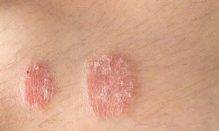 Ảnh minh hoạ: Internet