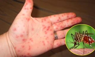 Ảnh minh hoạ: Internet