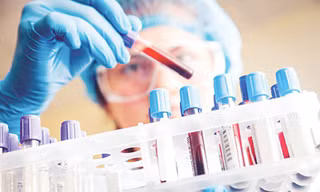 Nếu ăn phải sán lợn gạo thì chỉ từ 10 đến 15 ngày xét nghiệm máu bằng phương pháp ELISA là có thể phát hiện có dương tính với sán không. Ảnh minh hoạ: Internet