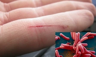 Ảnh minh họa: Internet