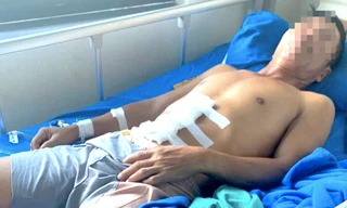 Gia Lai: Bệnh nhân vỡ ruột thừa do chẩn đoán sai, bệnh viện họp rút kinh nghiệm