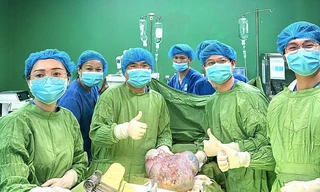 Người phụ nữ 10 năm 'gánh' khối u quái khủng lồ 