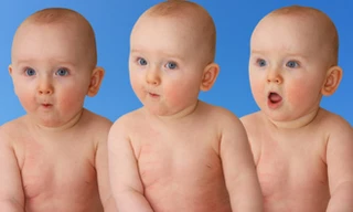 Sinh 3 đồng trứng là chuyện cực hiếm - Ảnh minh họa: Shutterstock