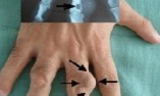 Ảnh minh họa: Internet