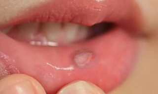 Ảnh minh họa: Internet