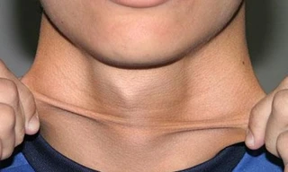 Ảnh minh họa: Internet