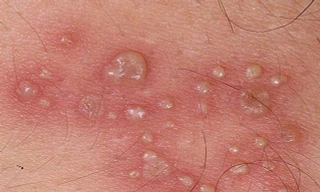 Ảnh minh hoạ: Internet