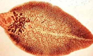 Ảnh minh hoạ: Internet