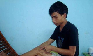 Những sự cố ‘quên’ dụng cụ trong người bệnh nhân sau phẫu thuật