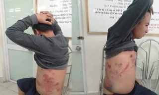 Ông Hà Văn Nam từng cho rằng, bản thân bị đánh vào ngày 28/1 vì phản đối trạm BOT thu phí sai.