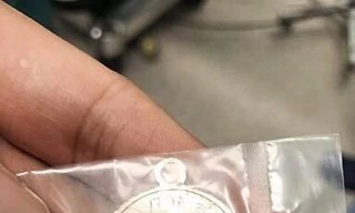 Bé trai 2 tuổi suýt chết vì nuốt chửng mặt dây chuyền