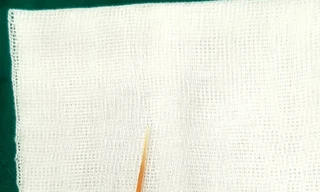 Bé gái 1 tuổi suýt chết vì nuốt phải tăm xỉa răng