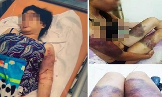 Bố cô gái bị giam giữ, tra tấn suốt 21 ngày: 'Tôi đau như chết đi sống lại'