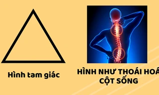 Kỳ nghỉ Tết sắp hết, đã đến lúc bắt tay "giải cứu" cột sống Gen Z trước những deadline!