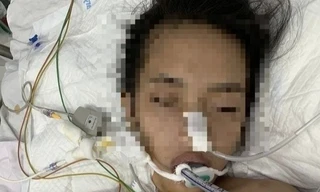 Cô gái đang thở máy, tiên lượng nặng 