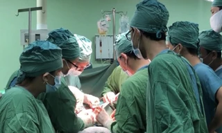 Các bác sỹ thực hiện kíp mổ cho bệnh nhân Phạm Văn T. Ảnh: T.U