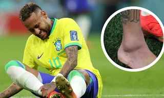 Brazil 'lo sốt vó' với chấn thương của Neymar