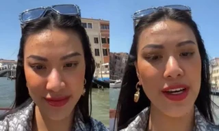 Dù là Á hậu Siêu quốc gia, Kim Duyên vẫn không né được mụn: Nguyên nhân do đâu?