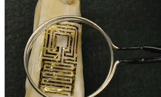 'Xăm răng' công nghệ cao để chuẩn đoán bệnh