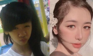 Chia tay vì bị chê bai ngoại hình, cô gái 21 tuổi “lột xác” nhờ phẫu thuật thẩm mỹ