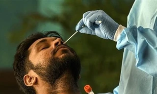 Biến thể COVID-19 mới XBB.1.16 gây ra các bệnh về mắt