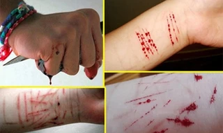 Vì sao học sinh có hành vi tự hủy hoại bản thân?