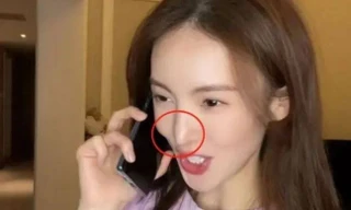 Nữ diễn viên Kim Thần bị biến dạng gương mặt