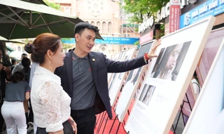 Bộ ảnh thay đổi cuộc đời người bị bạch biến