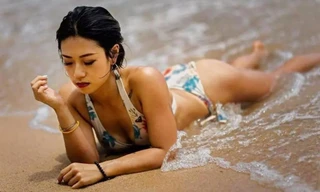 Á hậu Hong Kong trước khi bị liệt