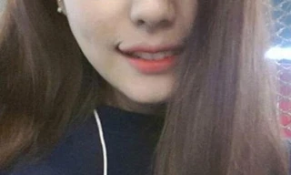 Gái Hàn quay cuồng với mốt tạo 'môi cười'