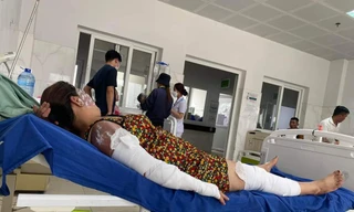 Nổ bình gas mini khi đang ăn lẩu, 7 người nhập viện