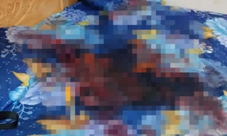 Nữ sinh lớp 12 cùng bạn trai thương vong trong nhà nghỉ