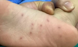 Cơ quan chức năng vào cuộc vụ trẻ em nghi bị bạo hành ở Bình Định