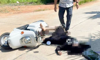 Thông tin mới nhất về sức khỏe Trung tá công an bị đánh chấn thương sọ não