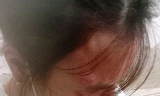 Nữ sinh lớp 10 ở Hà Tĩnh bị chủ quầy tạp hóa đánh chấn động não