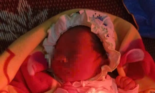 Bé sơ sinh còn nguyên dây rốn bị bỏ rơi trong túi nilon