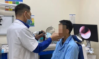 Đỉa dài 5cm sống trong mũi nam thanh niên gần cả tháng