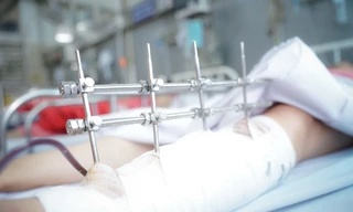 Nữ nạn nhân vụ sập tường kinh hoàng ở Long An đã thoát 'cửa tử'