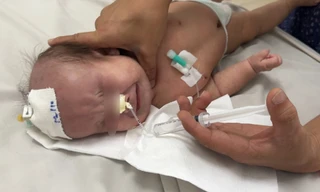 TPHCM: Bé gái 9 tháng tuổi tử vong vì tập phục hồi chức năng bởi bác sĩ giả mạo