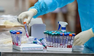 Biến thể phụ XBB.1.5 của COVID-19 xuất hiện tại TPHCM