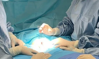 Lần đầu tiên tại Việt Nam nội soi trên xương mu can thiệp dị tật cho trẻ sơ sinh